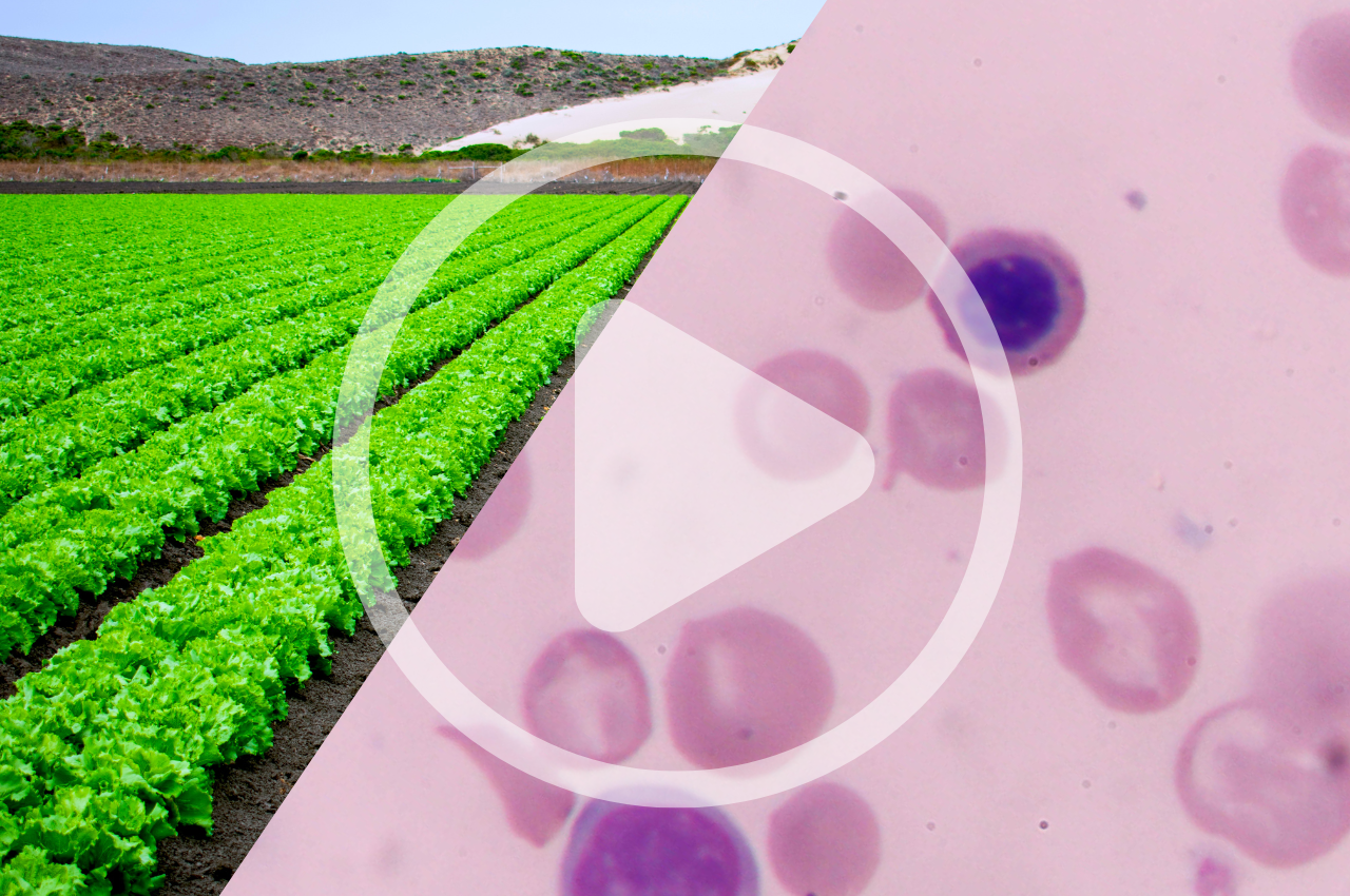 Large-scale Food and the Cyclospora Outbreak
